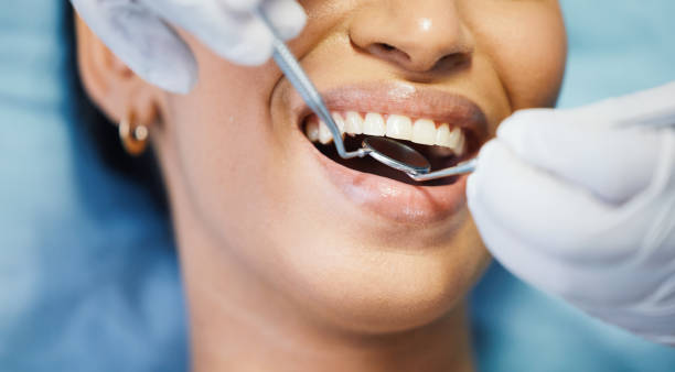 Best Walk-In Emergency Dentist in Southlake, TX